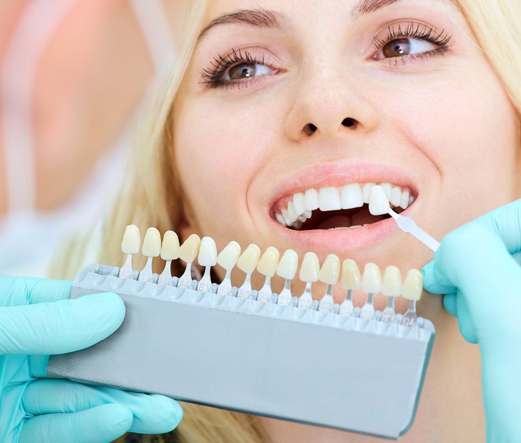 dentist showing veneers